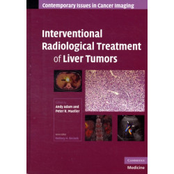 Interventional Radiological Treatment of Liver Tumors