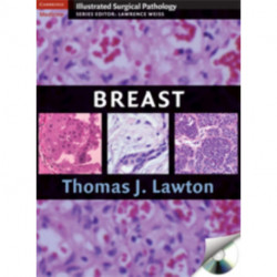 Breast