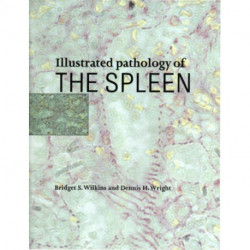 Illustrated Pathology of the Spleen
