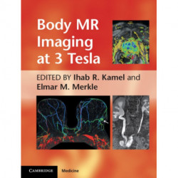 Body MR Imaging at 3 Tesla