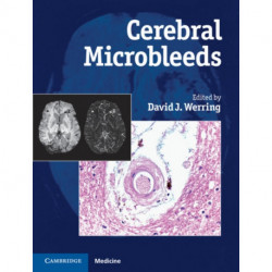 Cerebral Microbleeds: Pathophysiology to Clinical Practice