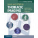 Pearls and Pitfalls in Thoracic Imaging: Variants and Other Difficult Diagnoses