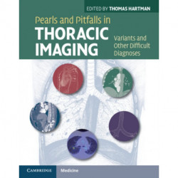 Pearls and Pitfalls in Thoracic Imaging: Variants and Other Difficult Diagnoses