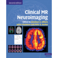 Clinical MR Neuroimaging: Physiological and Functional Techniques