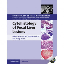 Cytohistology of Focal Liver Lesions