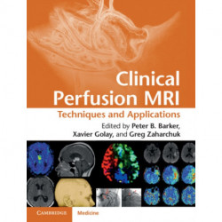 Clinical Perfusion MRI: Techniques and Applications