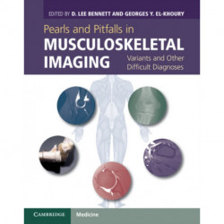 Pearls and Pitfalls in Musculoskeletal Imaging: Variants and Other Difficult Diagnoses