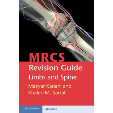 MRCS Revision Guide: Limbs and Spine