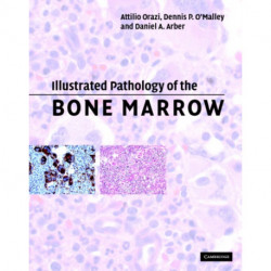 Illustrated Pathology of the Bone Marrow
