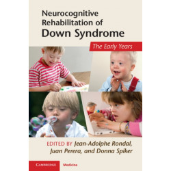 Neurocognitive Rehabilitation of Down Syndrome: Early Years