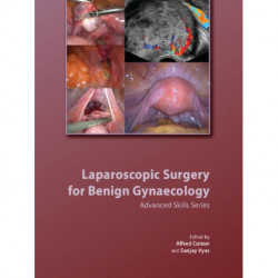 Laparoscopic Surgery for Benign Gynaecology Hardback with DVDs
