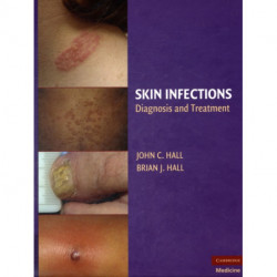 Skin Infections: Diagnosis and Treatment