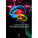 Neuroimaging: Sensing Biochemistry in the Brain