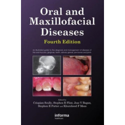 Oral and Maxillofacial Diseases