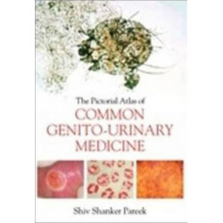 The Pictorial Atlas of Common Genito-Urinary Medicine