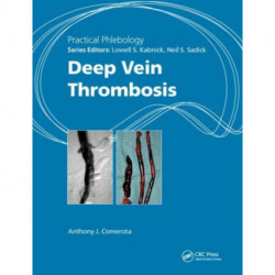 Practical Phlebology: Deep Vein Thrombosis