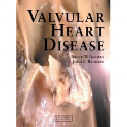 Valvular Heart Disease