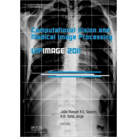 Computational Vision and Medical Image Processing: VipIMAGE 2011