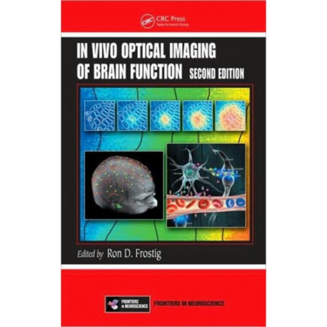 In Vivo Optical Imaging of Brain Function