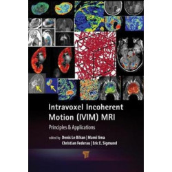 Intravoxel Incoherent Motion (IVIM) MRI: Principles and Applications