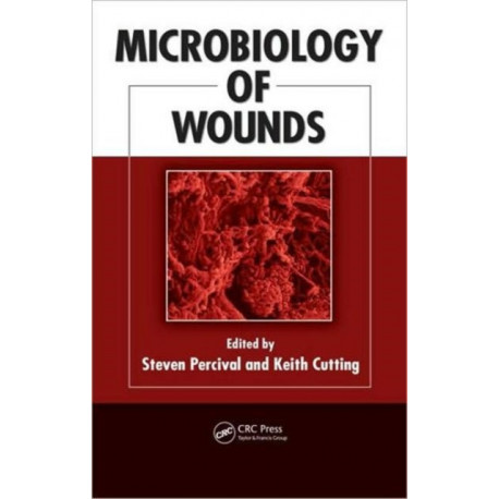 Microbiology of Wounds