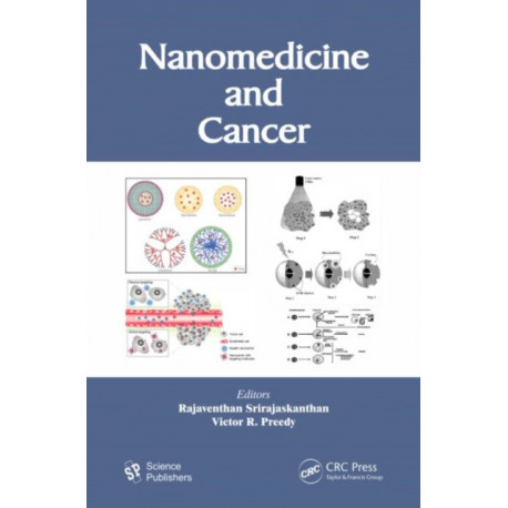 Nanomedicine and Cancer