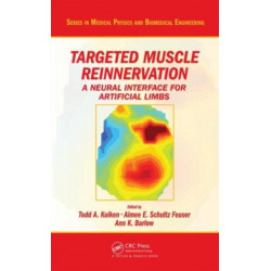 Targeted Muscle Reinnervation: A Neural Interface for Artificial Limbs