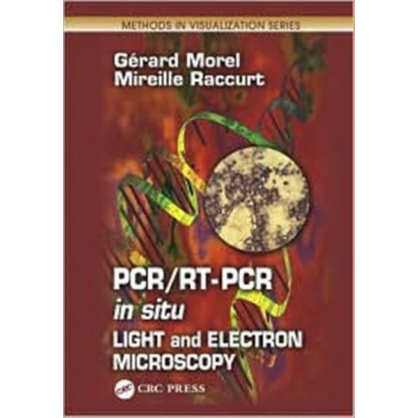 PCR/RT- PCR in situ: Light and Electron Microscopy