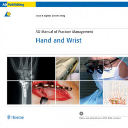 AO Manual of Fracture Management - Hand and Wrist