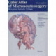 Color Atlas of Microneurosurgery: Volume 2 - Cerebrovascular Lesions: Microanatomy - Approaches - Techniques