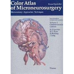 Color Atlas of Microneurosurgery: Volume 2 - Cerebrovascular Lesions: Microanatomy - Approaches - Techniques