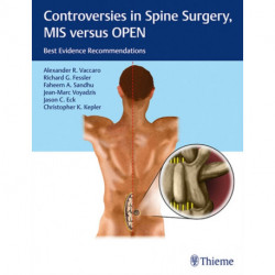 Controversies in Spine Surgery, MIS Versus OPEN: Best Evidence Recommendations