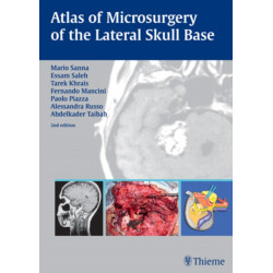 Atlas of Microsurgery of the Lateral Skull Base