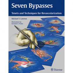 Seven Bypasses: Tenets and Techniques for Revascularization