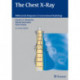 The Chest X-Ray