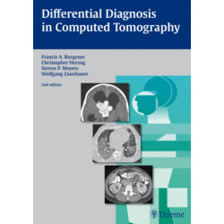 Differential Diagnosis in Computed Tomography