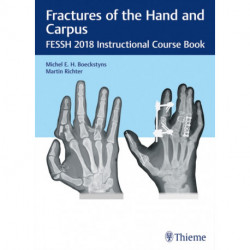 Fractures of the Hand and Carpus: FESSH 2018 Instructional Course Book