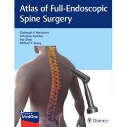 Atlas of Full-Endoscopic Spine Surgery
