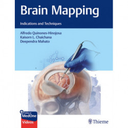 Brain Mapping: Indications and Techniques