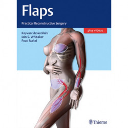 Flaps: Practical Reconstructive Surgery