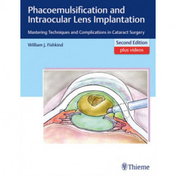 Phacoemulsification and Intraocular Lens Implantation: Mastering Techniques and Complications in Cataract Surgery