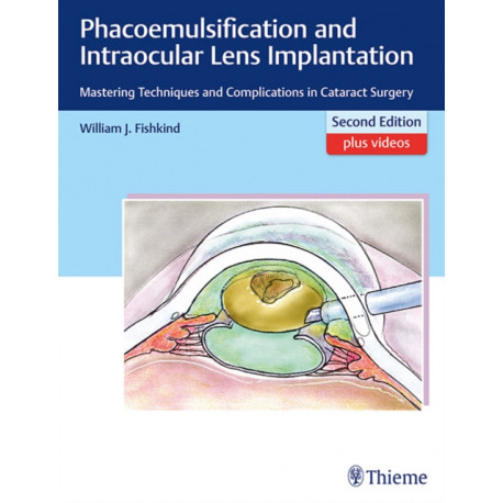 Phacoemulsification and Intraocular Lens Implantation: Mastering Techniques and Complications in Cataract Surgery