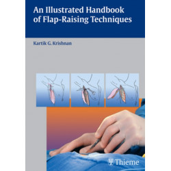 An Illustrated Handbook of Flap-Raising Techniques