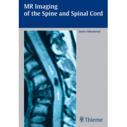 MR Imaging of the Spine and Spinal Cord