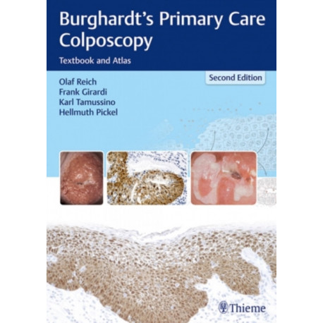 Burghardt's Primary Care Colposcopy: Textbook and Atlas
