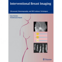 Interventional Breast Imaging: Ultrasound, Mammography, and MR Guidance Techniques