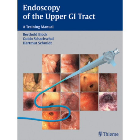 Endoscopy of the Upper GI Tract: A Training Manual