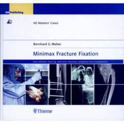 Minimax Fracture Fixation: AO Masters' Cases