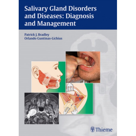 Salivary Gland Disorders and Diseases:: Diagnosis and Management