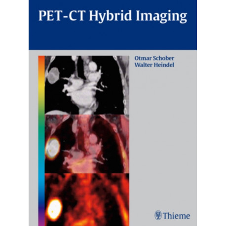 PET-CT Hybrid Imaging